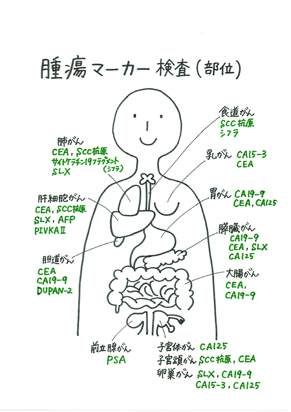 腫瘍マーカー検査